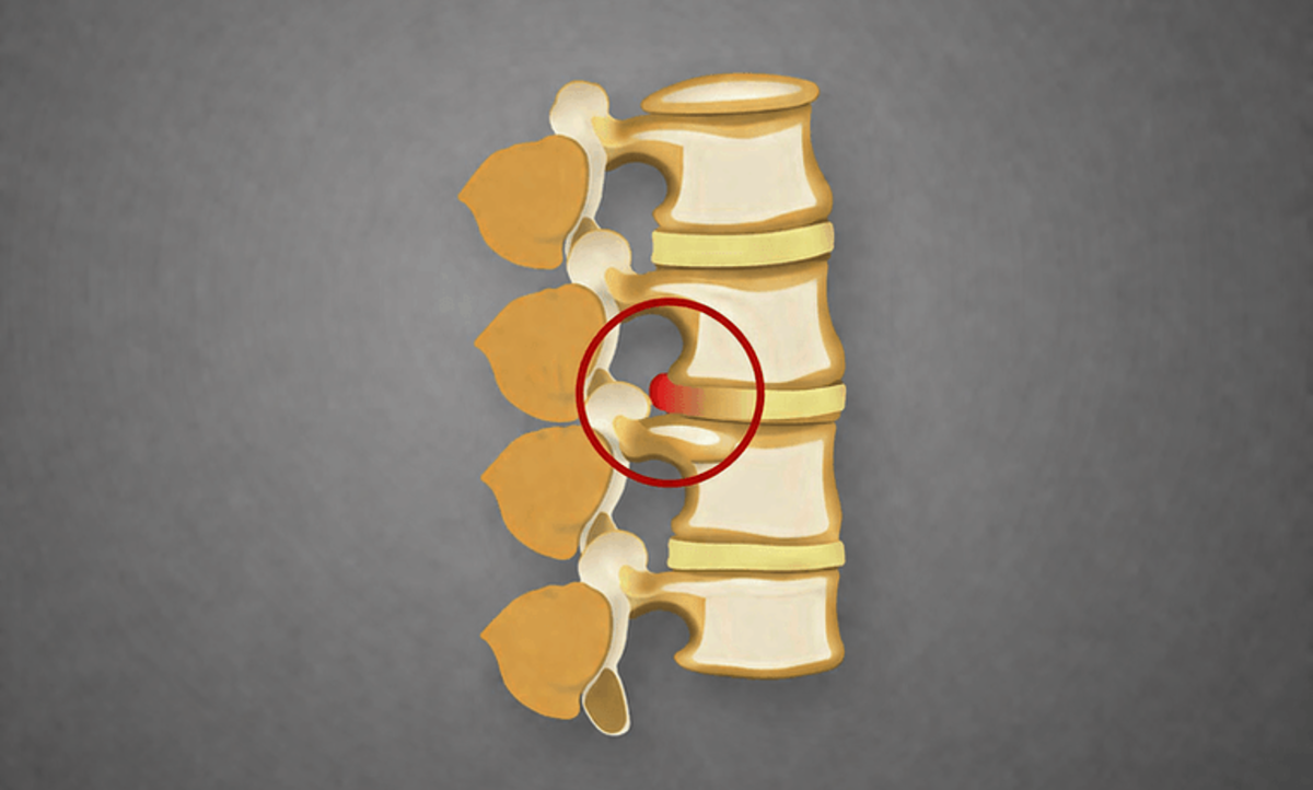 obrázok časti chrbtice s vyznačeným pruhom