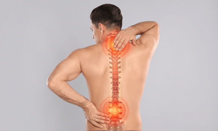 chrbát muža s vykreslenou chrbticou a boľavými miestami