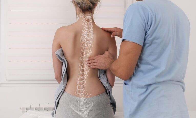 lekár vyšetrujúci ženský chrbát s vyznačenou skoliózou
